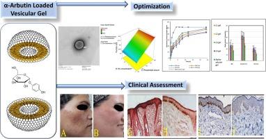 Nano-vesicular systems for melanocytes targeting and melasma treatment: In-vitro characterization, ex-vivo skin retention, and preliminary clinical appraisal