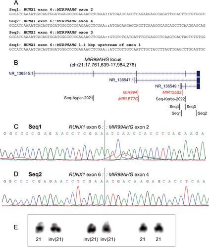 RUNX1::MIR99AHG Chimera in Acute Myeloid Leukemia