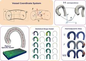 A robust shape model for blood vessels analysis