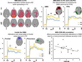 Breakdown of TMS evoked EEG signal propagation within the default mode network in Alzheimer’s disease