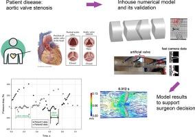 Flow through a prosthetic mechanical aortic valve: Numerical model and experimental study