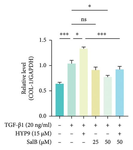 Salvianolic Acid B Inhibits Myocardial Fibrosis during Diabetic Cardiomyopathy via Suppressing TRPC6 and TGF-β/Smad3 Pathway