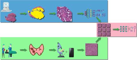 Artificial intelligence-based pathological application to predict regional lymph node metastasis in Papillary Thyroid Cancer