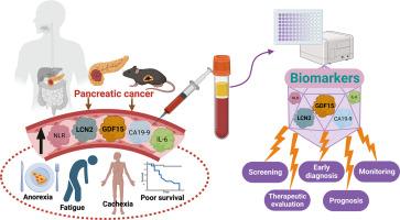 GDF15 and LCN2 for early detection and prognosis of pancreatic cancer