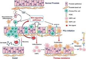 Combination therapies with Wnt signaling inhibition: A better choice for prostate cancer treatment