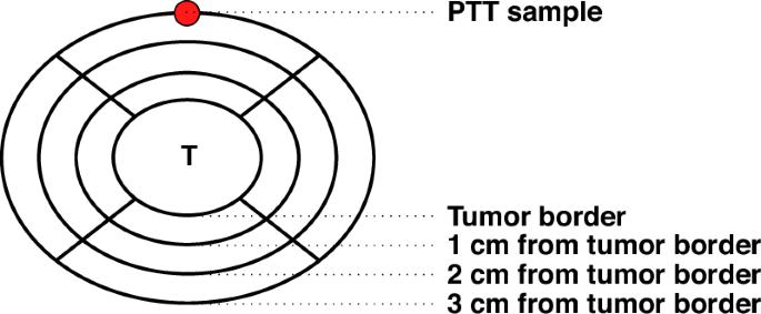 Peritumoral tissue (PTT): increasing need for naming convention