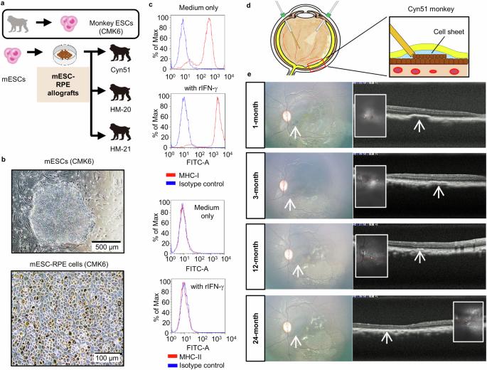 Graft survival of major histocompatibility complex deficient stem cell-derived retinal cells