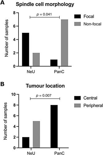 Genomic analysis defines distinct pancreatic and neuronal subtypes of lung carcinoid