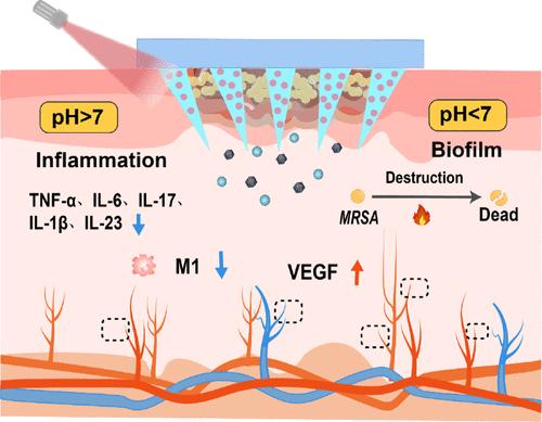 Au Nanorods Activate Zn2+/Ag+ Mediated Anti-inflammatory for Enhanced Methicillin-Resistant Wound Repair via Bionic Claw Microneedles