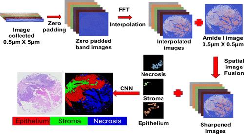 Rapid Hyperspectral Photothermal Mid-Infrared Spectroscopic Imaging from Sparse Data for Gynecologic Cancer Tissue Subtyping