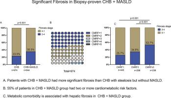 Prevalence and risk factors of significant fibrosis in chronic hepatitis B patients with concurrent metabolic dysfunction-associated steatotic liver disease