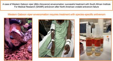 A case of Western Gaboon viper (Bitis rhinoceros) envenomation: Successful treatment with South African Institute for Medical Research (SAIMR) antivenom after North American crotalid antivenom failure