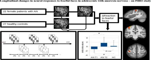 Longitudinal changes in neural responses to fearful faces in adolescents with anorexia nervosa – A fMRI study