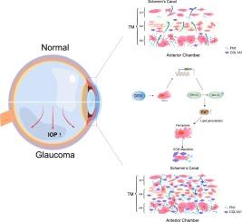 TMCO1 promotes ferroptosis and ECM deposition in glaucomatous trabecular meshwork via ERK1/2 signaling