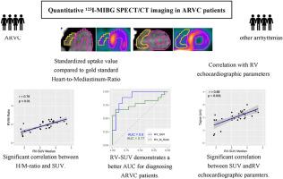 Quantitative assessment of cardiac 123iodo-metaiodobenzylguanidine SPECT/CT in patients with arrhythmogenic right ventricular cardiomyopathy: Novel insight in disease monitoring