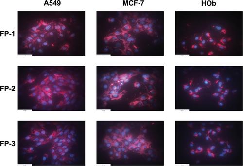 Innovative Fluorescent Polymers in Niosomal Carriers: A Novel Approach to Enhancing Cancer Therapy and Imaging