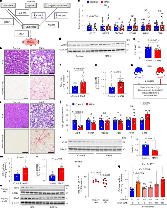 Inhibition of hepatic oxalate overproduction ameliorates metabolic dysfunction-associated steatohepatitis