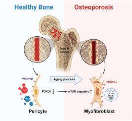 FOXO1-mTOR pathway in vascular pericyte regulates the formation of type H vessels to control bone metabolism