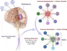 Vagus nerve stimulation: Novel concept for the treatment of glioblastoma and solid cancers by cytokine (interleukin-6) reduction, attenuating the SASP, enhancing tumor immunity