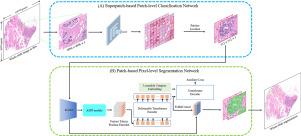 BreasTDLUSeg: A coarse-to-fine framework for segmentation of breast terminal duct lobular units on histopathological whole-slide images