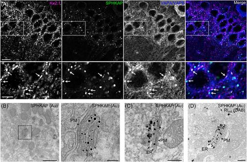 Compartmentalized signaling in the soma: Coordination of electrical and protein kinase A signaling at neuronal ER-plasma membrane junctions