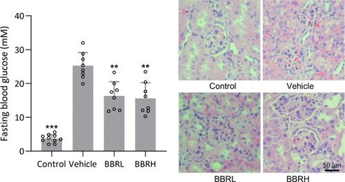 Berberine Inhibits KLF4 Promoter Methylation and Ferroptosis to Ameliorate Diabetic Nephropathy in Mice