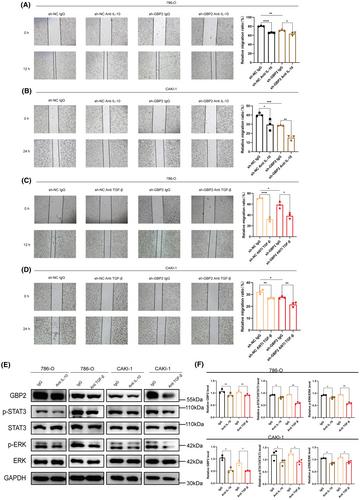 Crosstalk between GBP2 and M2 macrophage promotes the ccRCC progression