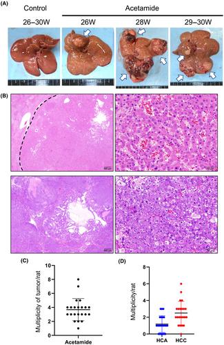 Chromosome aberrations cause tumorigenesis through chromosomal rearrangements in a hepatocarcinogenesis rat model