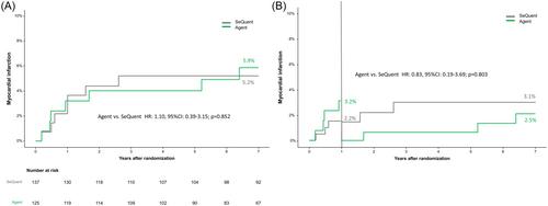 Comparative long-term efficacy and safety of two paclitaxel-coated balloons with different coating strategies for the treatment of drug-eluting coronary stent restenosis