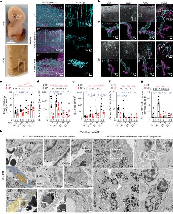 Proinflammatory immune cells disrupt angiogenesis and promote germinal matrix hemorrhage in prenatal human brain