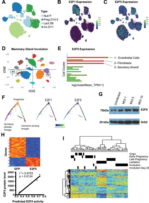 Insight into mammary gland development and tumor progression in an E2F5 conditional knockout mouse model