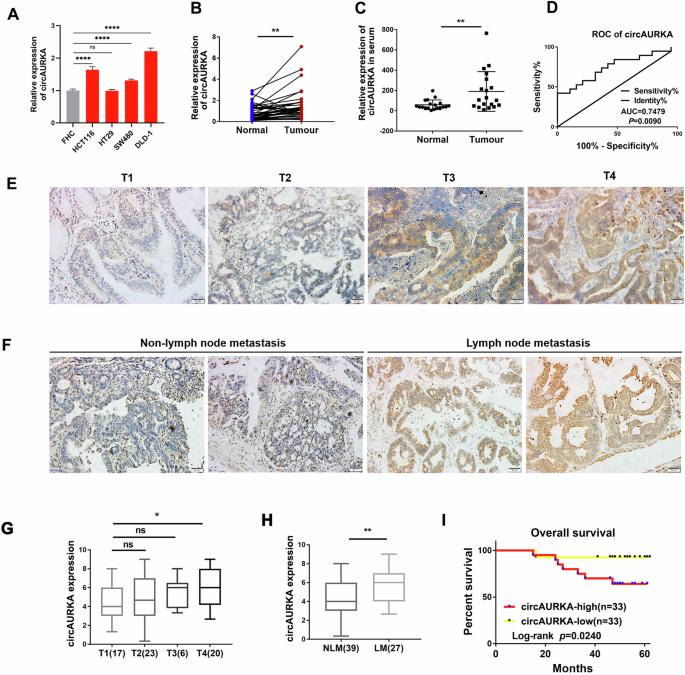 Targeting CircAURKA prevents colorectal cancer progression via enhancing CTNNB1 protein degradation