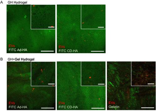 Engineering and Monitoring the Sustained Release of Extracellular Vesicles from Hydrogels for In Vivo Therapeutic Applications