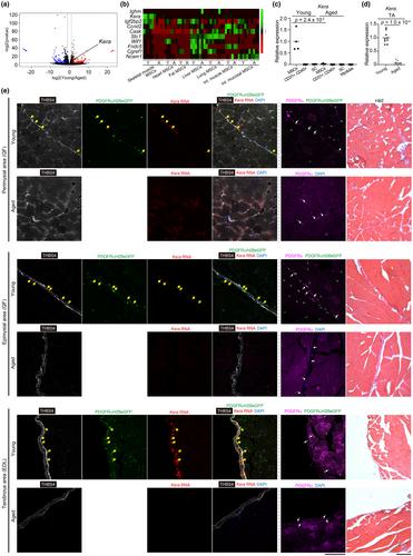 Tissue-specific functions of MSCs are linked to homeostatic muscle maintenance and alter with aging