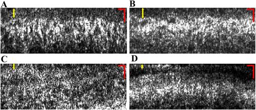 Characterizing Biomechanics of Limbal Niche Using Vibrational Optical Coherence Elastography