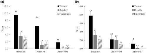 Stepwise dual-target magnetic resonance-guided focused ultrasound in tremor-dominant Parkinson disease: One-year follow-up