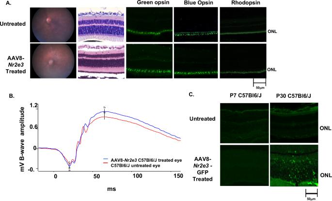 Correction: Nr2e3 is a genetic modifier that rescues retinal degeneration and promotes homeostasis in multiple models of retinitis pigmentosa