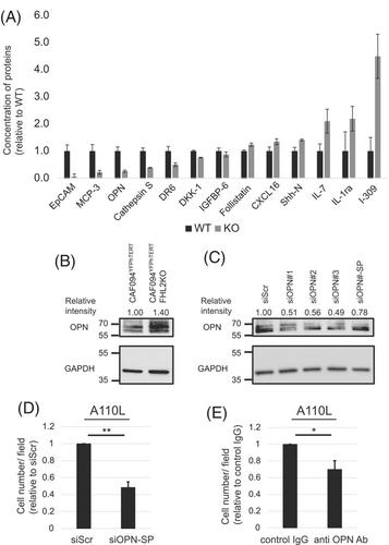 FHL2 expression by cancer-associated fibroblasts promotes metastasis and angiogenesis in lung adenocarcinoma