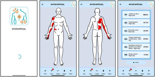 MyofAPPcial: Construct validity of a novel technological aid for improving clinical reasoning in the management of myofascial pain syndrome