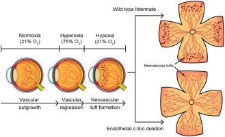 Endothelial c-Src Mediates Neovascular Tuft Formation in Oxygen-Induced Retinopathy