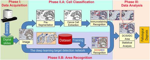 Histopathologic Differential Diagnosis and Estrogen Receptor/Progesterone Receptor Immunohistochemical Evaluation of Breast Carcinoma Using a Deep Learning–Based Artificial Intelligence Architecture