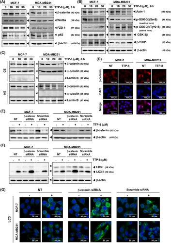 Thiouracil and triazole conjugate induces autophagy through the downregulation of Wnt/β-catenin signaling pathway in human breast cancer cells