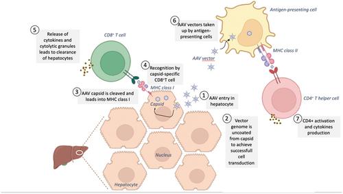 Drug-induced liver injury related to gene therapy: A new challenge to be managed