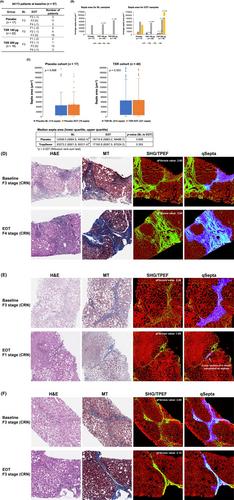 Digital quantitation of bridging fibrosis and septa reveals changes in natural history and treatment not seen with conventional histology