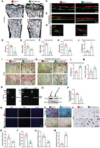 Bmi-1 Epigenetically Orchestrates Osteogenic and Adipogenic Differentiation of Bone Marrow Mesenchymal Stem Cells to Delay Bone Aging