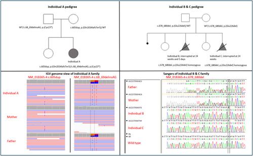 Expanding MNS1 Heterotaxy Phenotype