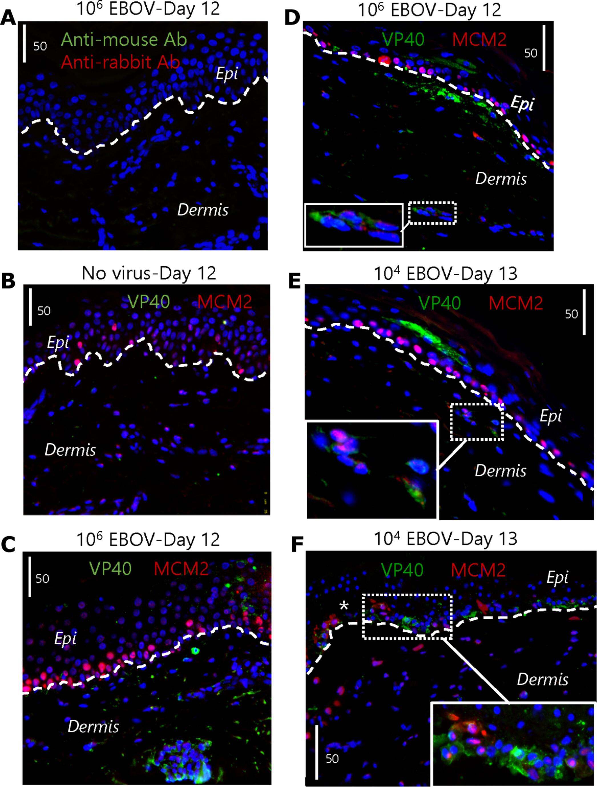 Multiple cell types support productive infection and dynamic translocation of infectious Ebola virus to the surface of human skin