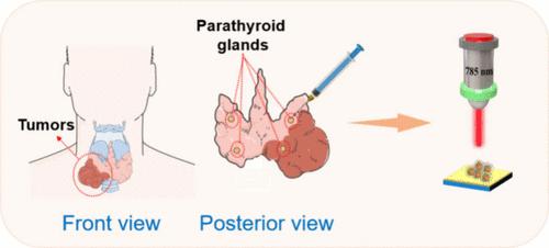 Aptamer-Antibody Birecognized Sandwich SERRS Biosensor in Accurate and Rapid Identification of Intraoperative Parathyroid Hormone