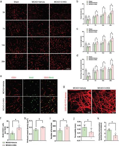 3-HKA Promotes Vascular Remodeling After Stroke by Modulating the Activation of A1/A2 Reactive Astrocytes