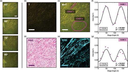 Leveraging Optical Anisotropy of the Morpho Butterfly Wing for Quantitative, Stain-Free, and Contact-Free Assessment of Biological Tissue Microstructures